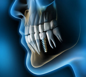 Medical Visualisation